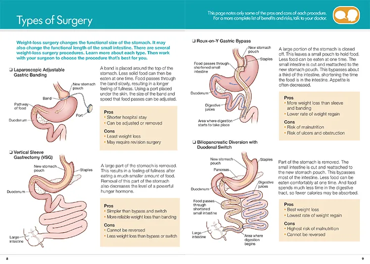 Post Bariatric Surgery Must Haves 